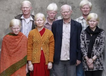 Cамая большая семья альбиносов в мире
